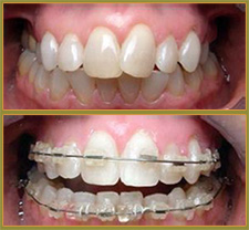 BEFORE & AFTER TREATMENT