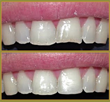 BEFORE & AFTER TREATMENT