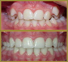 BEFORE & AFTER TREATMENT